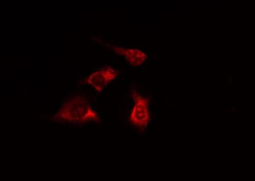 Polyclonal Rabbit anti-Human SPTAN1 / Alpha Fodrin Antibody (IF, WB)