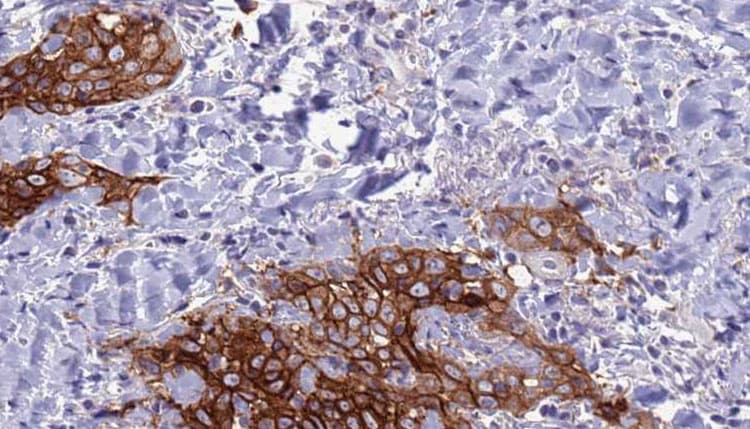 Polyclonal Rabbit anti-Human CD72 Antibody (IHC, WB)