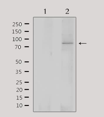 Polyclonal Rabbit anti-Human SATB1 Antibody (WB)