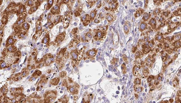 Polyclonal Rabbit anti-Human GRIN2A / NMDAR2A / NR2A Antibody (IHC, IF, WB)