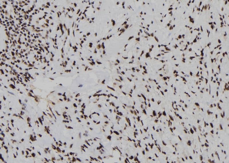 Polyclonal Rabbit anti-Human DUSP3 / VHR Antibody (IHC, WB)