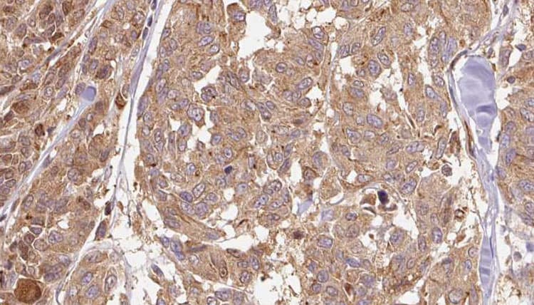 Polyclonal Rabbit anti-Human PNP / Nucleoside Phosphorylase Antibody (IHC, WB)