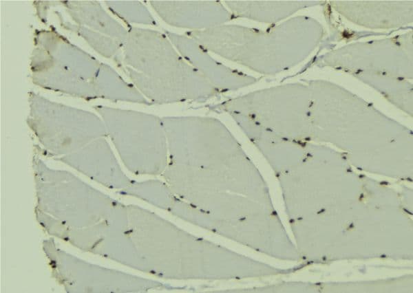Polyclonal Rabbit anti-Human Transportin-SR / TNPO3 Antibody (IHC, WB)