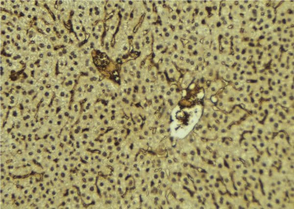 Polyclonal Rabbit anti-Human FUS / TLS Antibody (IHC, WB)