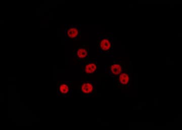 Polyclonal Rabbit anti-Human SSB / La Antibody (IF, WB)