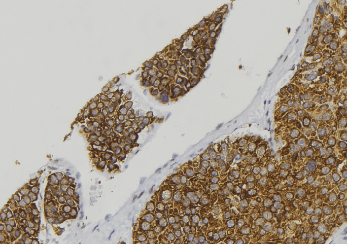 Polyclonal Rabbit anti-Human CALCA Antibody (IHC, IF, WB)