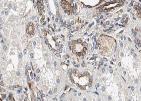 Polyclonal Rabbit anti-Human CTSH / Cathepsin H Antibody (IHC, IF, WB)