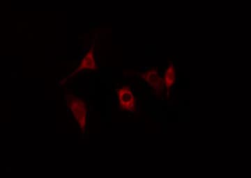 Polyclonal Rabbit anti-Human CTSH / Cathepsin H Antibody (IHC, IF, WB)