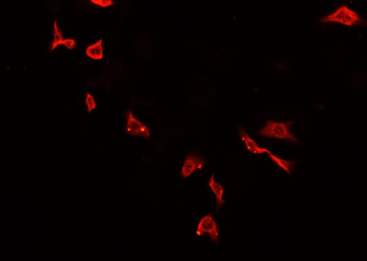 Polyclonal Rabbit anti-Human SCNN1G / ENaC Gamma Antibody (IF, WB)