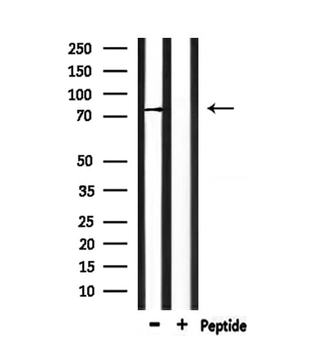 Polyclonal Rabbit anti-Human SCNN1G / ENaC Gamma Antibody (IF, WB)