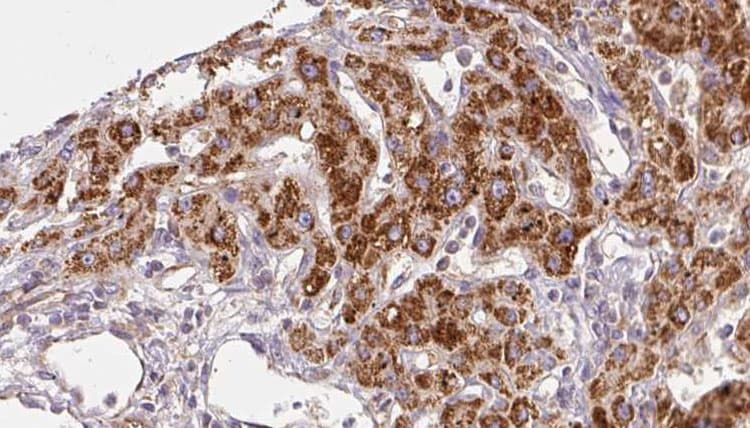 Polyclonal Rabbit anti-Human GABRA1 Antibody (IHC, WB)