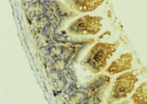 Polyclonal Rabbit anti-Human NTN1 / Netrin 1 Antibody (IHC, WB)