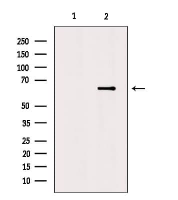Polyclonal Rabbit anti-Human NTN1 / Netrin 1 Antibody (IHC, WB)