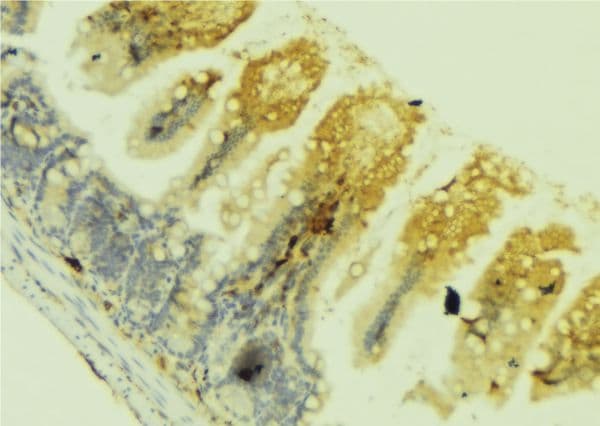 Polyclonal Rabbit anti-Human SEMA3C / Semaphorin 3C Antibody (IHC, WB)