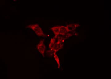 Polyclonal Rabbit anti-Human ACTN1 Antibody (IF, WB)