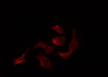 Polyclonal Rabbit anti-Human ELAVL2 / HUB Antibody (IF, WB)
