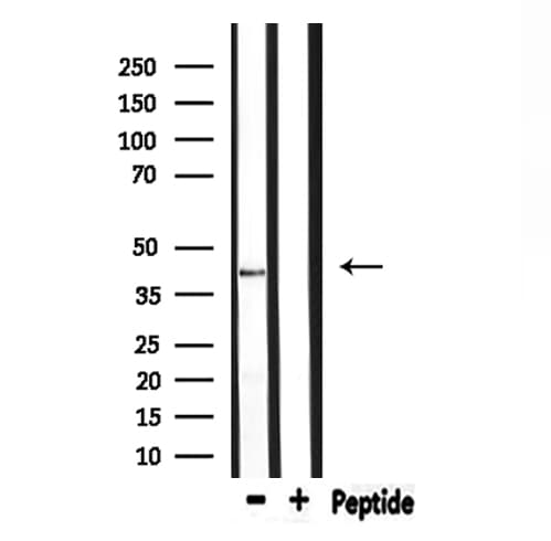 Polyclonal Rabbit anti-Human ELAVL2 / HUB Antibody (IF, WB)