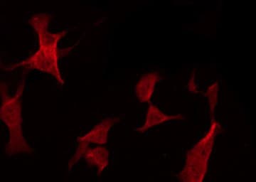 Polyclonal Rabbit anti-Human Neurofibromin / NF1 Antibody (IF, WB)