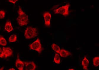 Polyclonal Rabbit anti-Human OR4Q3 Antibody (IF, WB)