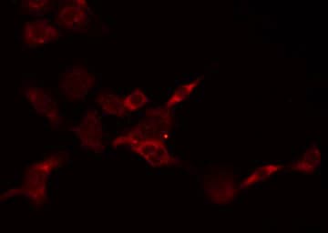Polyclonal Rabbit anti-Human PSCA Antibody (IF, WB)