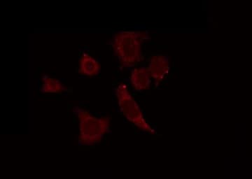 Polyclonal Rabbit anti-Human GTF3C4 Antibody (IF, WB)