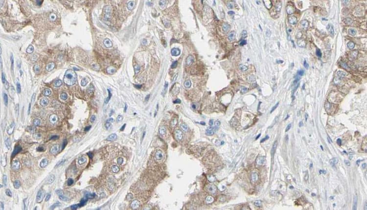 Polyclonal Rabbit anti-Human MAP3K1 / MEKK1 Antibody (phospho-Thr1402, IHC, IF, WB)