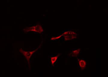 Polyclonal Rabbit anti-Human MAP3K1 / MEKK1 Antibody (phospho-Thr1402, IHC, IF, WB)