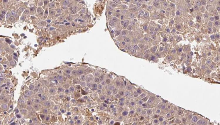 Polyclonal Rabbit anti-Human CD52 Antibody (IHC, WB)