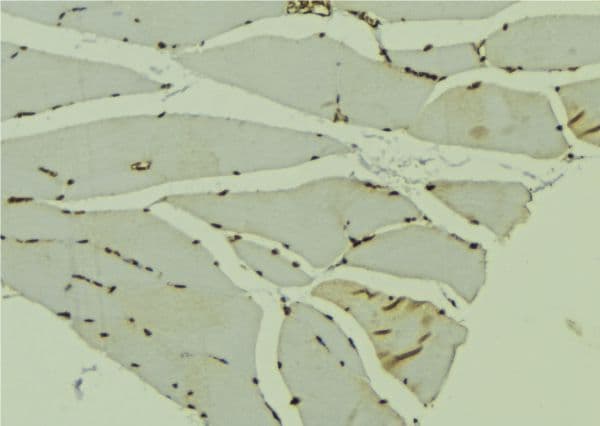 AKAP6 / MAKAP Antibody