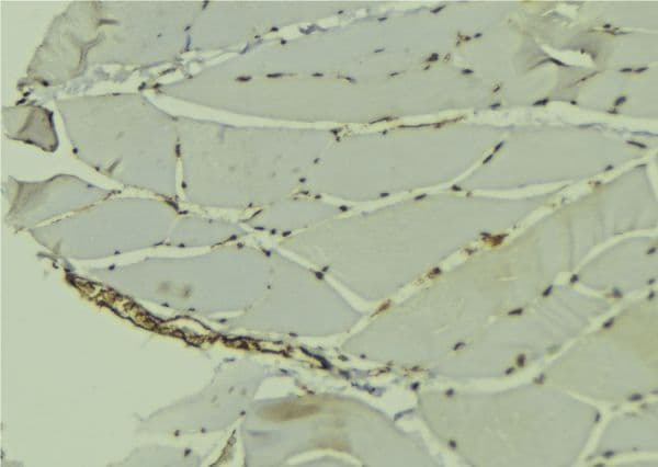 Polyclonal Rabbit anti-Human HnRNP-E1 / PCBP1 Antibody (IHC, WB)