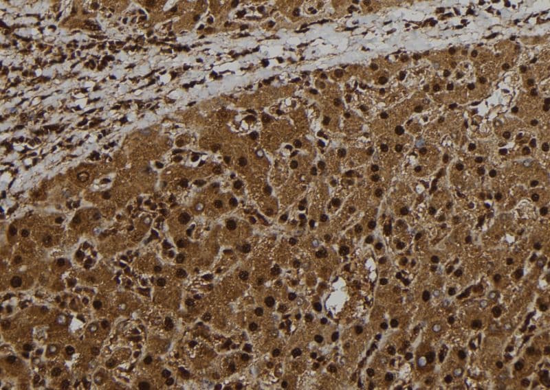Polyclonal Rabbit anti-Human CT47 Antibody (IHC, WB)