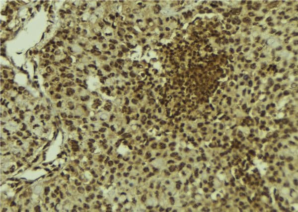 Polyclonal Rabbit anti-Human MORF / MYST4 Antibody (IHC, WB)