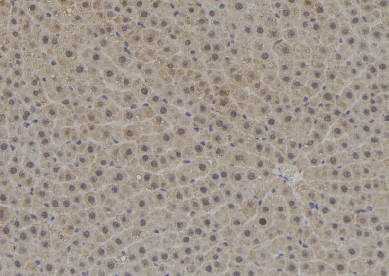 Polyclonal Rabbit anti-Human TPD52L3 Antibody (IHC, WB)