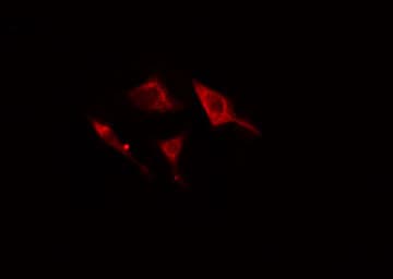 Polyclonal Rabbit anti-Human AK5 / Adenylate Kinase 5 Antibody (IF, WB)