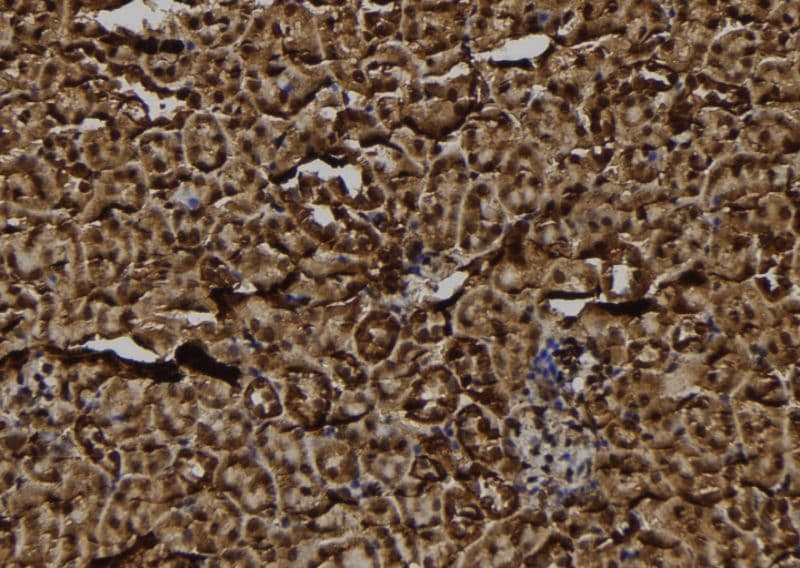 Polyclonal Rabbit anti-Human FKSG2 Antibody (IHC, WB)