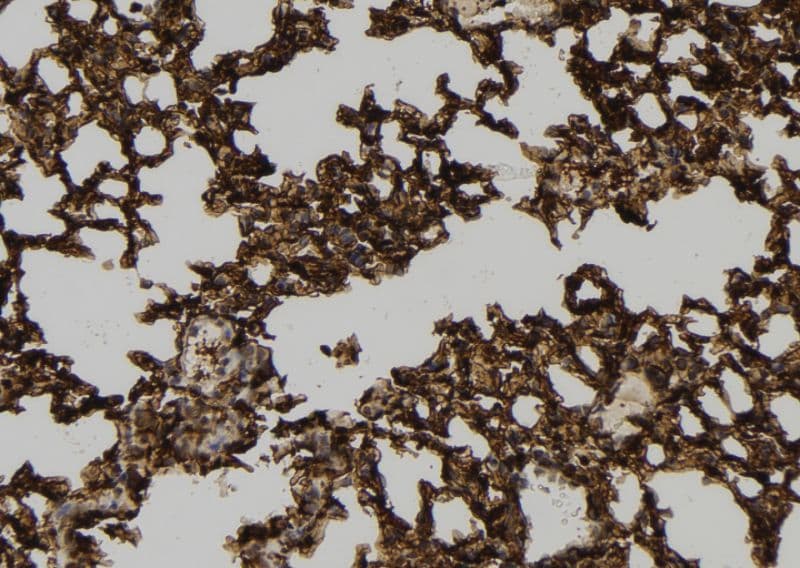 Polyclonal Rabbit anti-Human NKIRAS1 Antibody (IHC, WB)