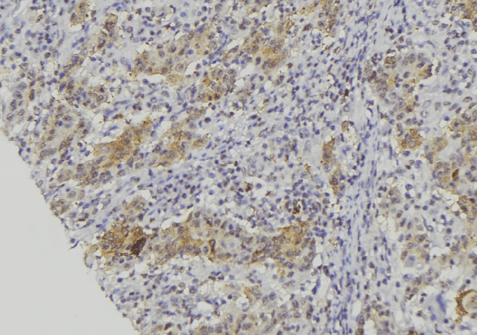 Polyclonal Rabbit anti-Human CALML5 Antibody (IHC, WB)