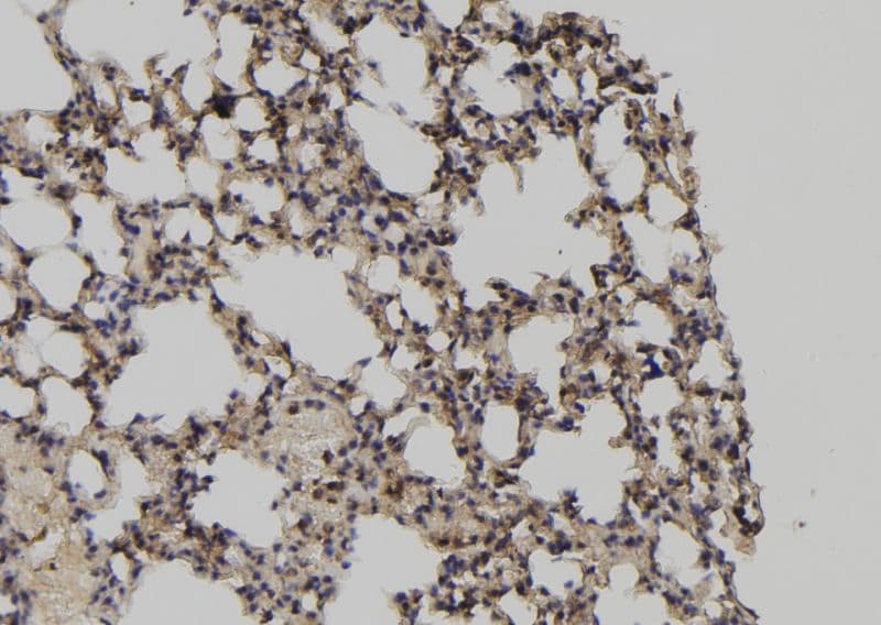 Polyclonal Rabbit anti-Human CAPN3 / Calpain 3 Antibody (IHC, WB)