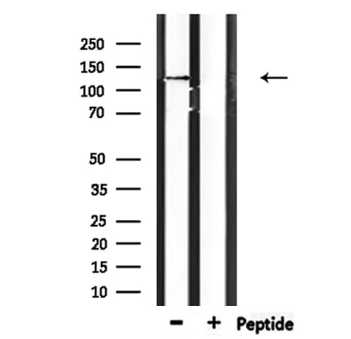 Polyclonal Rabbit anti-Human CTNND2 / Delta-2 Catenin Antibody (WB)