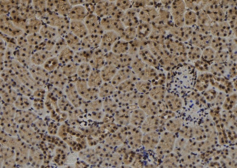 Polyclonal Rabbit anti-Human CDR1 Antibody (IHC, WB)