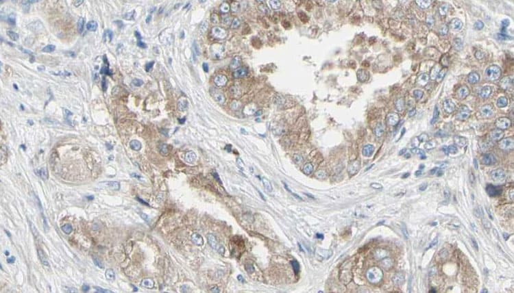PLA2G4F Antibody