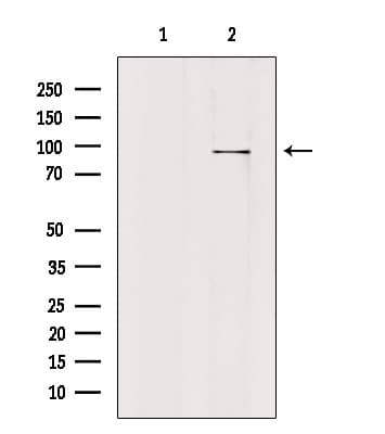 PLA2G4F Antibody