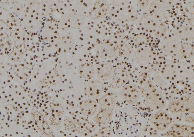 Polyclonal Rabbit anti-Human FANCM Antibody (IHC, WB)
