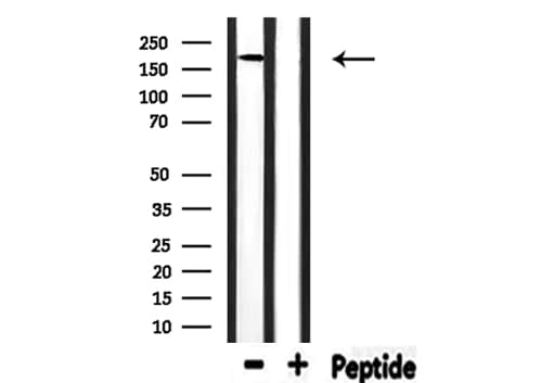 Polyclonal Rabbit anti-Human FANCM Antibody (IHC, WB)