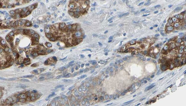 Polyclonal Rabbit anti-Human Gephyrin Antibody (IHC, WB)