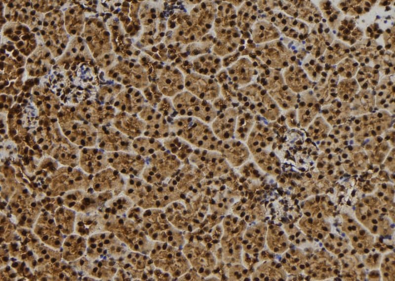 QSER1 Antibody