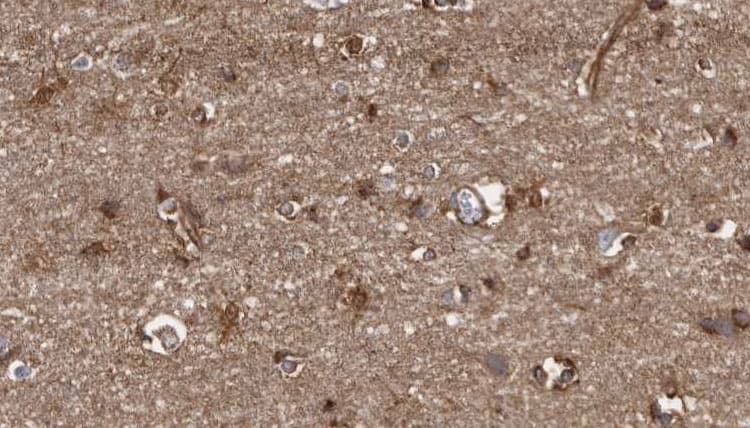 Polyclonal Rabbit anti-Human ICAM5 / ICAM-5 Antibody (IHC, IF, WB)