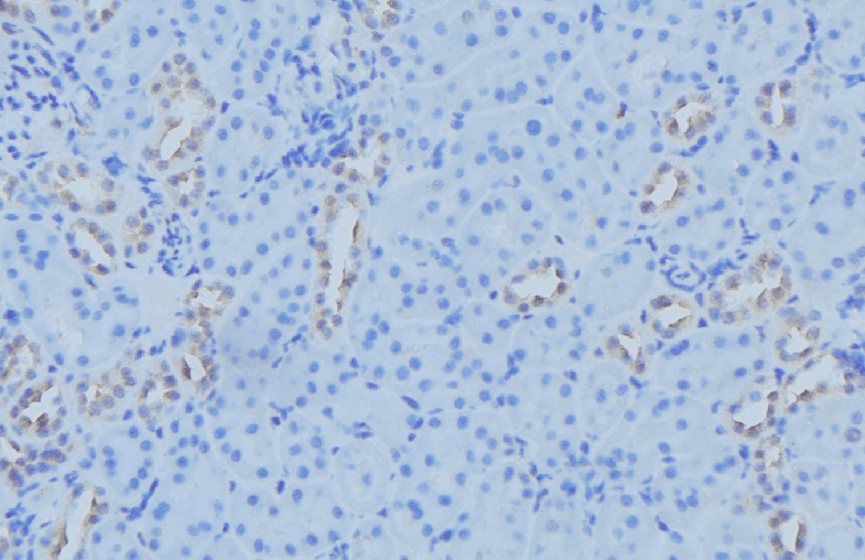 MT-ND2 Antibody