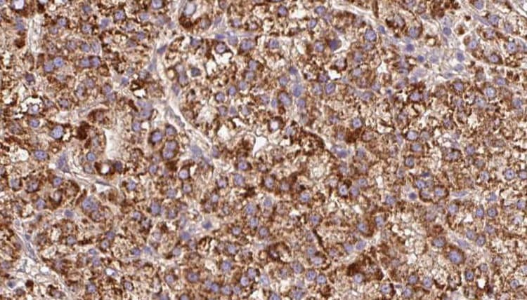 Polyclonal Rabbit anti-Human GPM6A / Glycoprotein M6A Antibody (IHC, WB)