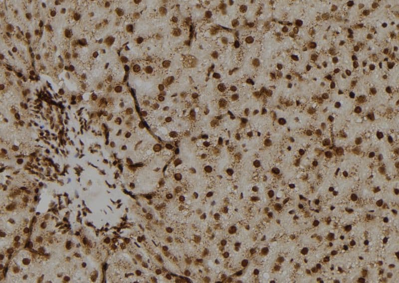 Polyclonal Rabbit anti-Human OAZ2 Antibody (IHC, WB)